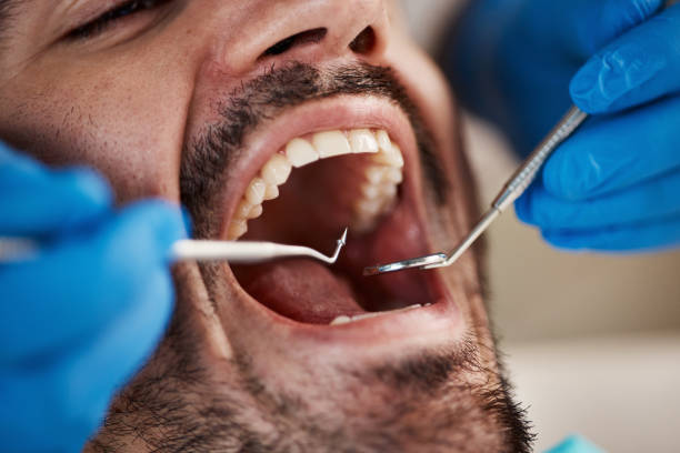 Best Tooth Infection Emergency Dentist  in Ocean Park, WA